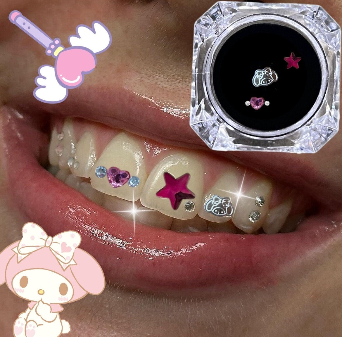 My Melody Zahnschmuck | Sanrio Titananhänger