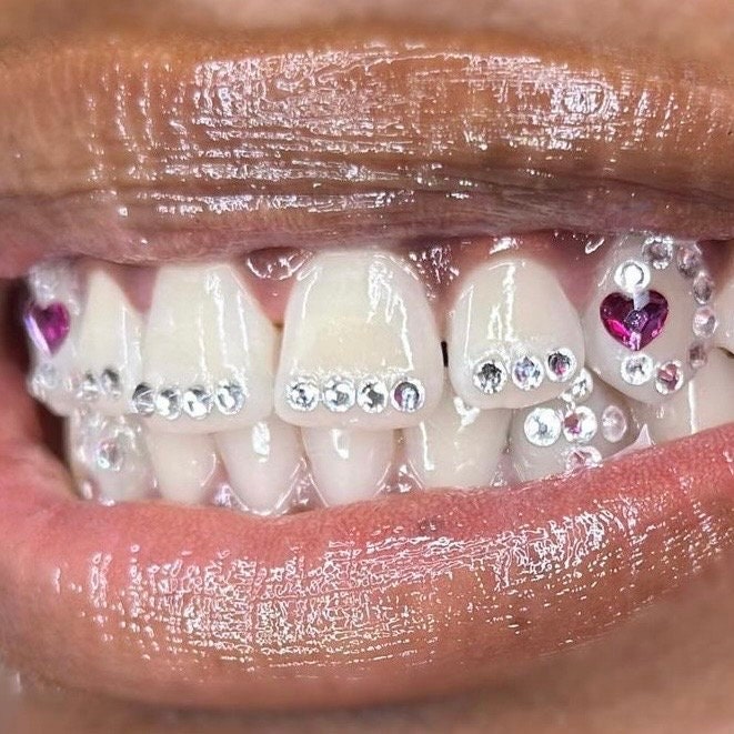 Herz Zahnspangen Swarovski Zahnschmuck-Set | DIY Set